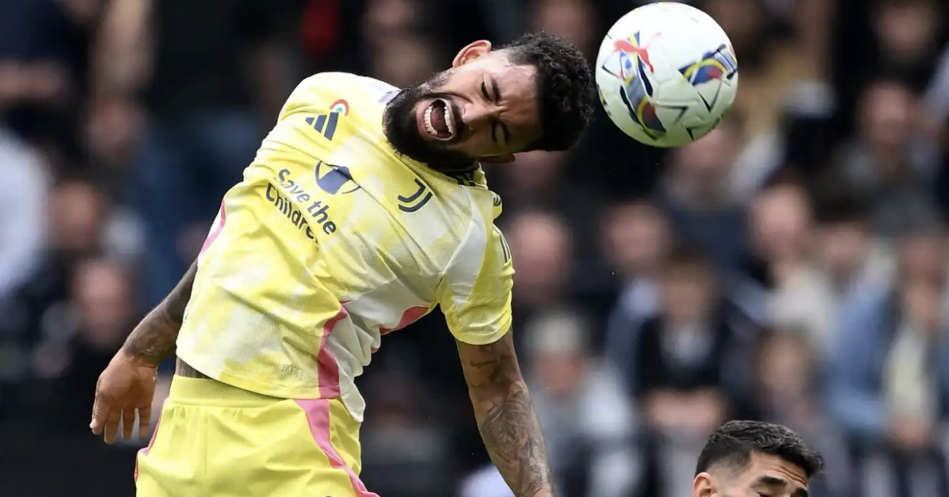 Douglas ora è un problema